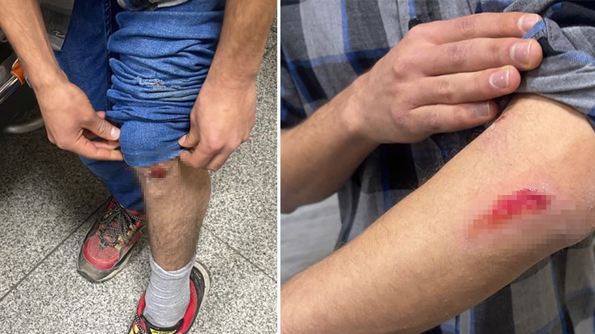 Yer Şanlıurfa! Başıboş sokak köpekleri, otobüs bekleyen gence saldırdı
