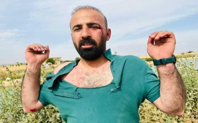 Şanlıurfa'da Seçim Kavgası: YSP'li Vekil Dahil, 5 Yaralı Şanlıurfa'da Seçim Kavgası: YSP'li Vekil Dahil, 5 Yaralı