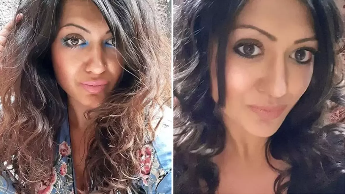 Popüler yöntemle yumurta pişirmek isteyen kadının son halini görenlerin içi gidiyor