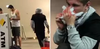 Şaka yapmak isteyen YouTuber'ın burnu kırıldı