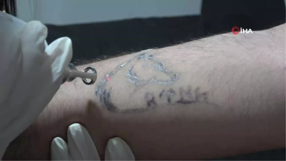 Uzmanından lazer epilasyon uyarısı: 'Yüz bölgesine yapılan lazer epilasyonlarında yüzde 90 sonuç alınamıyor'