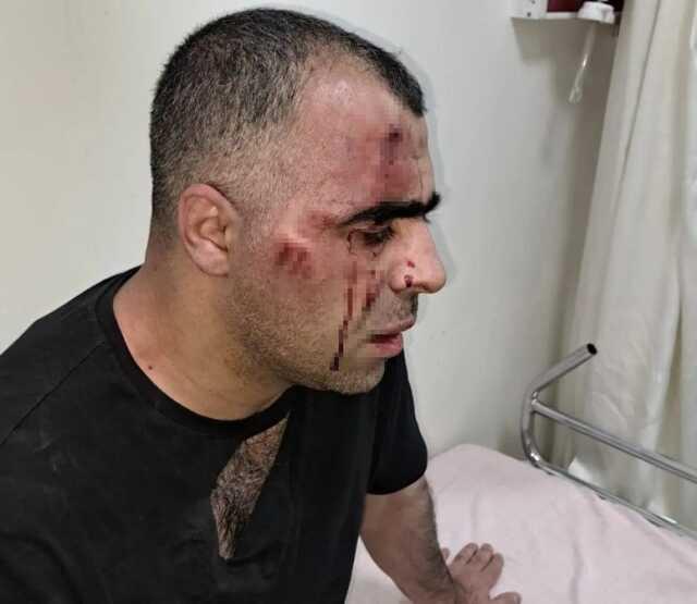 BİGACEM Başkanı Aygül'e saldırıya ilişkin 1'i polis 2 kişi gözaltına alındı BİGACEM Başkanı Aygül'e saldırıya ilişkin 1'i polis 2 kişi gözaltına alındı