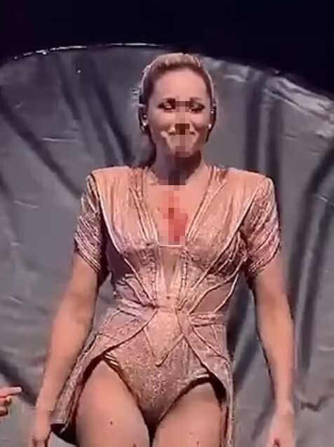 Alman pop yıldızı Helene Fischer konser sırasında yaşadığı trapez kazası sonrası yüzü kanlar içinde kaldı Alman pop yıldızı Helene Fischer konser sırasında yaşadığı trapez kazası sonrası yüzü kanlar içinde kaldı