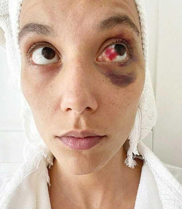 Şiddet davasında yeni gelişme! Ozan Güven cephesi kendi photoshop iddiasını boşa çıkardı: Araştırılmasın Şiddet davasında yeni gelişme! Ozan Güven cephesi kendi photoshop iddiasını boşa çıkardı: Araştırılmasın