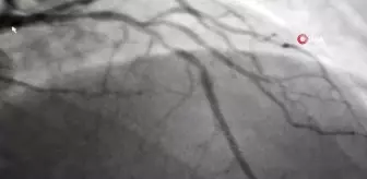 Uzmanlar, Kurban Bayramı için beslenme önerilerinde bulundu