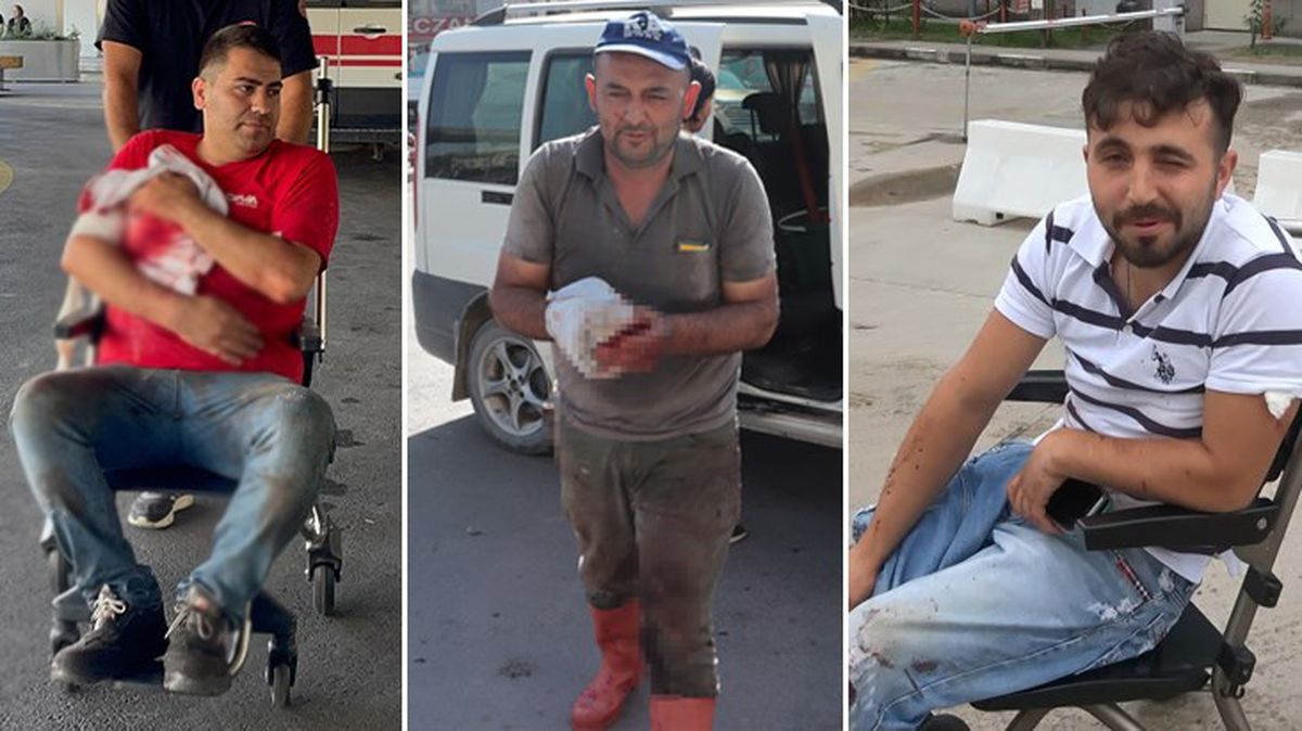 Memleketten kurban manzaraları! Acemi kasaplar her yıl olduğu gibi bu bayram da acilleri doldurdu