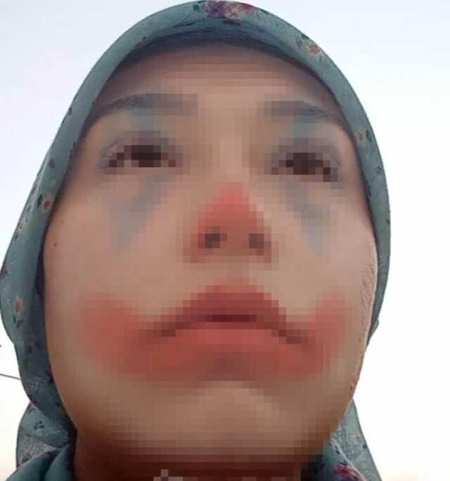 Niğde'de zorla evlendirilmek istenen kız çocuğunun ailesi ve damat adayı gözaltına alındı