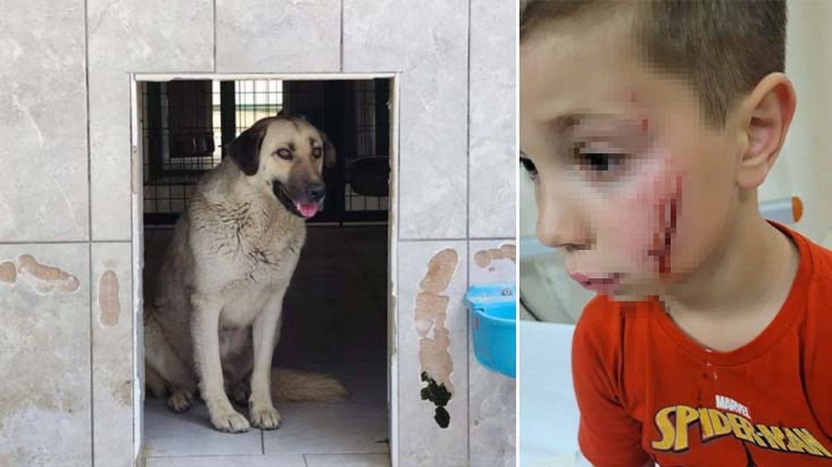 Tatil için Türkiye'ye gelen küçük çocuğa, başıboş sokak köpeği saldırdı