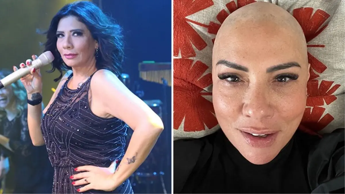 Işın Karaca, uzun zamandır taşıdığı hastalığı bu fotoğrafla paylaştı: Saklamak artık zor gelmeye başladı