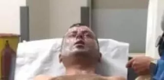 Körfez'de Lavabo Açıcı Patladı, Bir Kişi Yaralandı