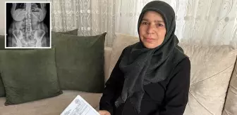 Ameliyattan sonra aylarca ağrı çeken kadının karnında makas unutulduğu ortaya çıktı