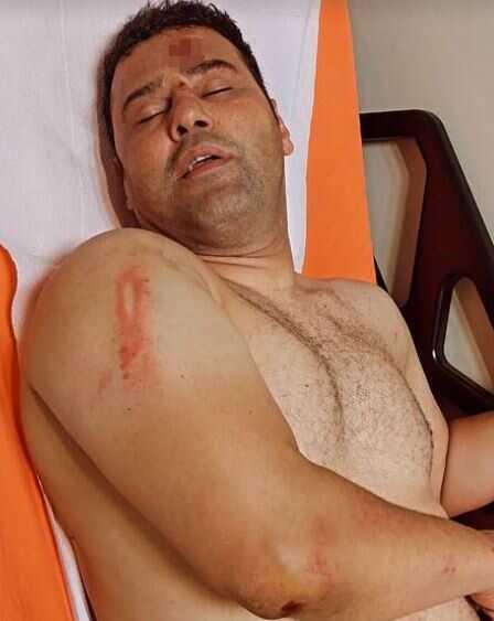 Survivor yarışmacısı, başcazgırı hastanelik etti: Kafama kafama vurdu, beni öldürmeye çalıştı Survivor yarışmacısı, başcazgırı hastanelik etti: Kafama kafama vurdu, beni öldürmeye çalıştı