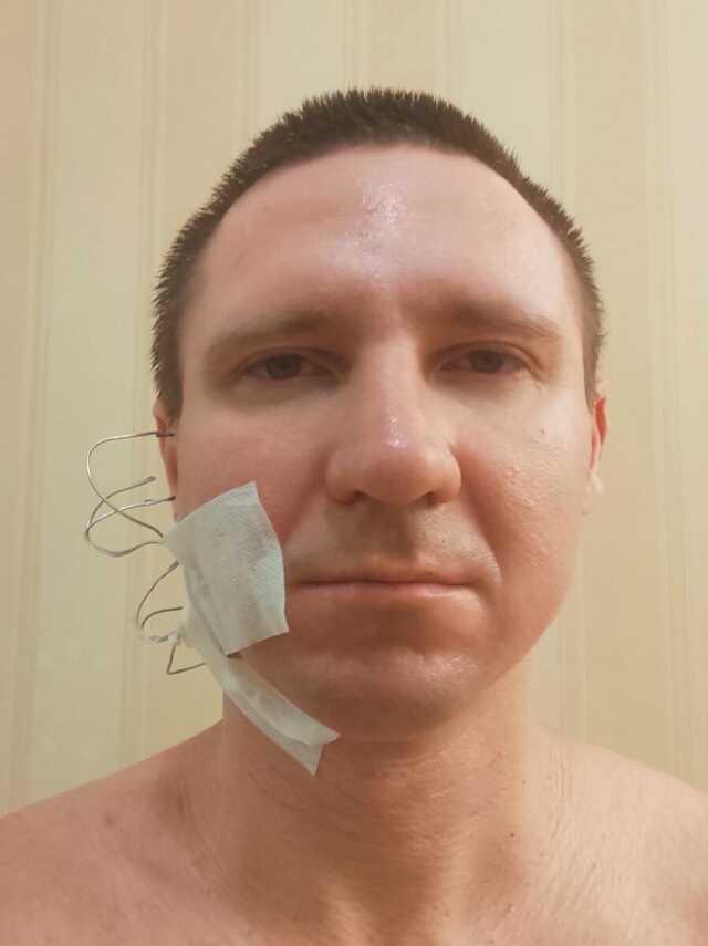 Rusya'da Bir Kişi Rüyalarını Kontrol Edebilmek İçin Kafasını Matkapla Deldi Rusya'da Bir Kişi Rüyalarını Kontrol Edebilmek İçin Kafasını Matkapla Deldi