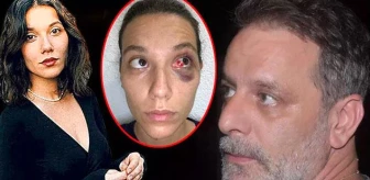 Ozan Güven'in eski kız arkadaşının yüzündeki yaralanma hafif değil