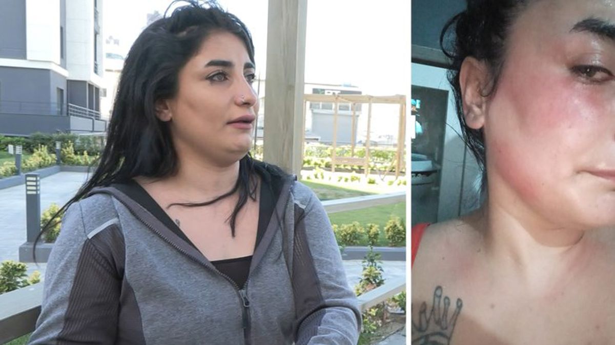 Darp sonucu bebeğini düşüren kadından vahim iddia: Verdiğim hiçbir rapor ortada yok