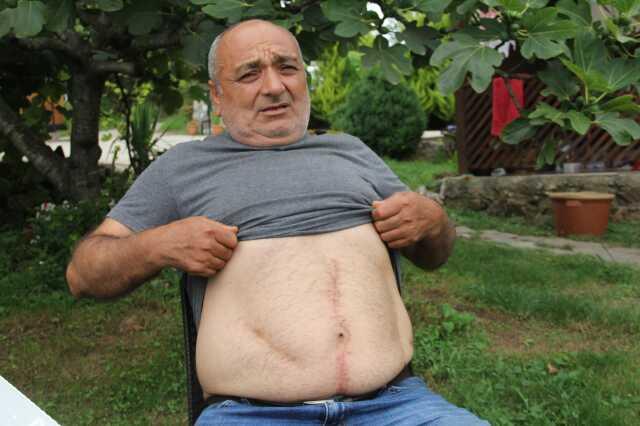 Geçirdiği ameliyatta karnından 3 parça gazlı bez unutuldu! Gerçeği 18 yıl sonra öğrendi Geçirdiği ameliyatta karnından 3 parça gazlı bez unutuldu! Gerçeği 18 yıl sonra öğrendi