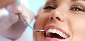 Diş taşı nedir, neden olur? Belirtileri ve tedavisi