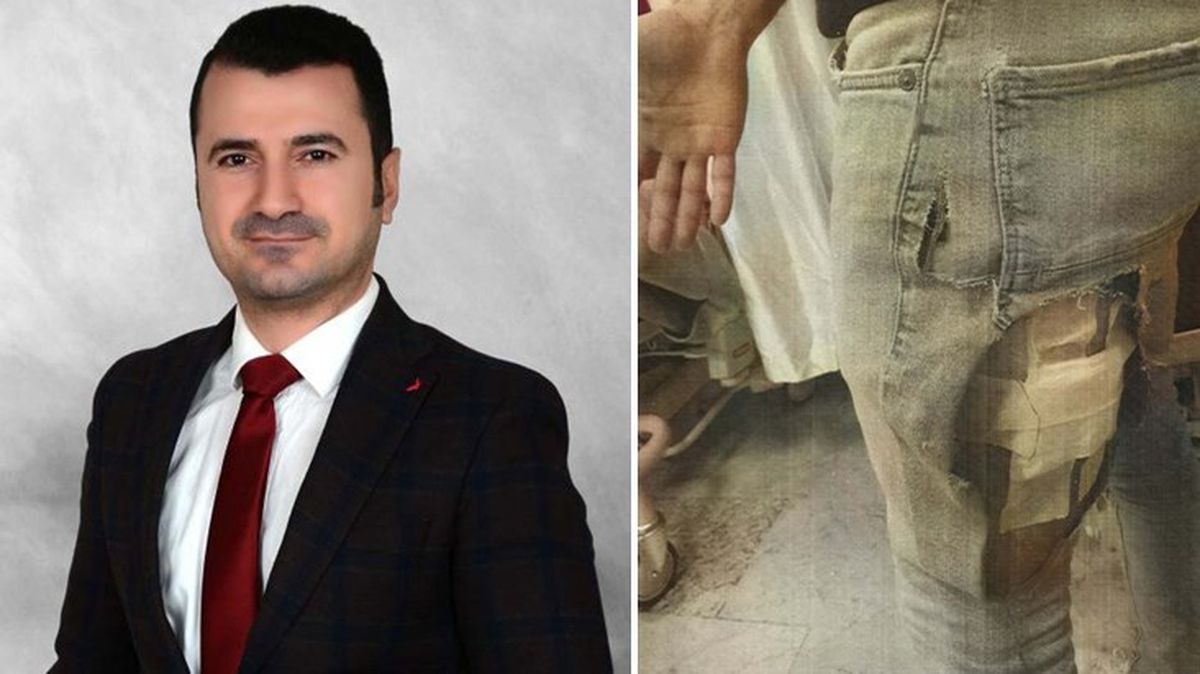 Sokak köpeklerinin yaraladığı avukat, İzmir Büyükşehir Belediyesi'ne açtığı tazminat davasını kazandı