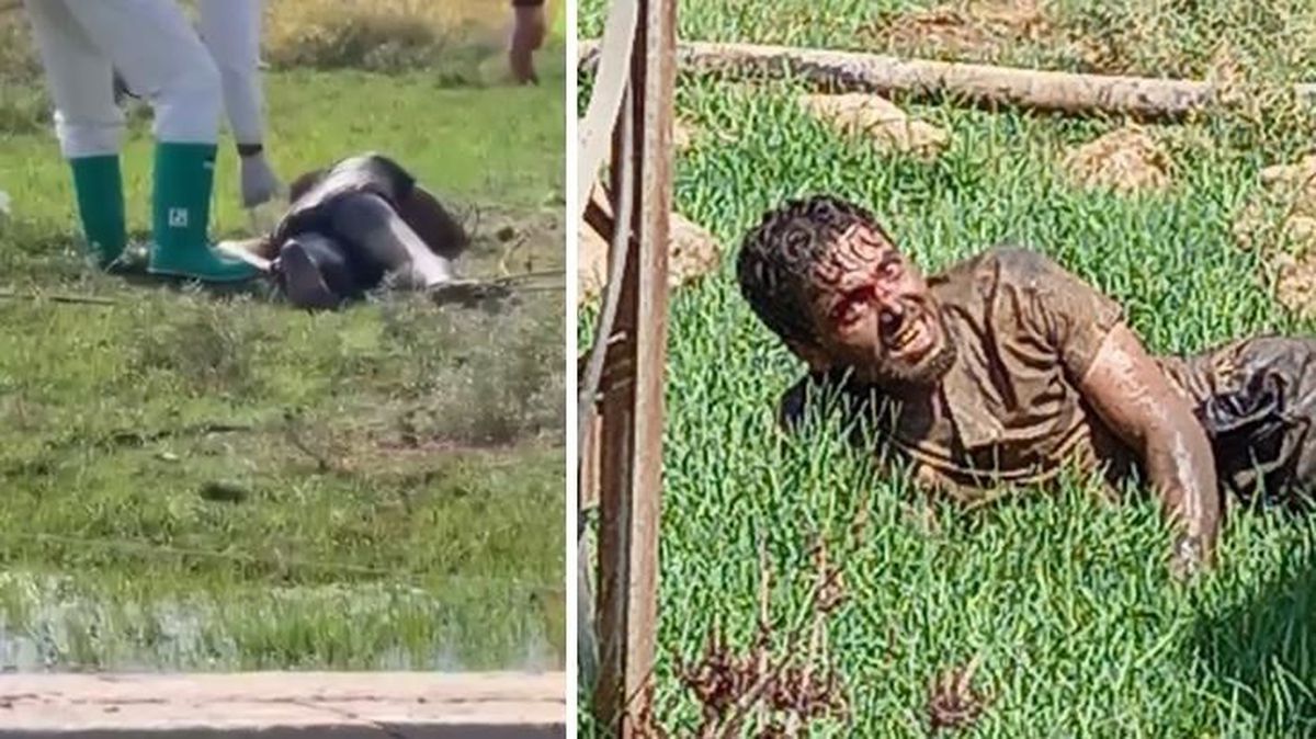 Hastaneden kaçmıştı! Kuduz teşhisiyle tedavi gören adam hayatını kaybetti