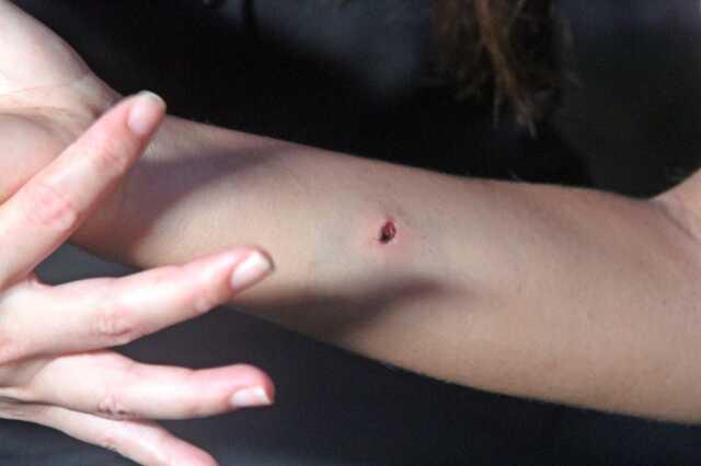 Dershaneye giden 12 yaşındaki çocuk, başıboş gezen 5 köpeğin saldırısına uğradı