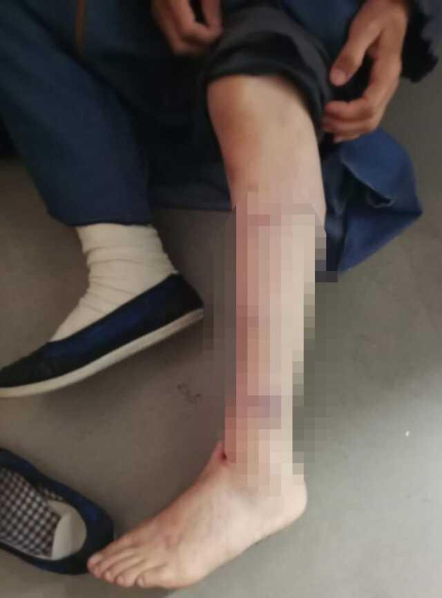 İmamoğlu'nun danışmanı Murat Ongun'un 'Thor' isimli köpeği belediye çalışanına saldırdı İmamoğlu'nun danışmanı Murat Ongun'un 'Thor' isimli köpeği belediye çalışanına saldırdı