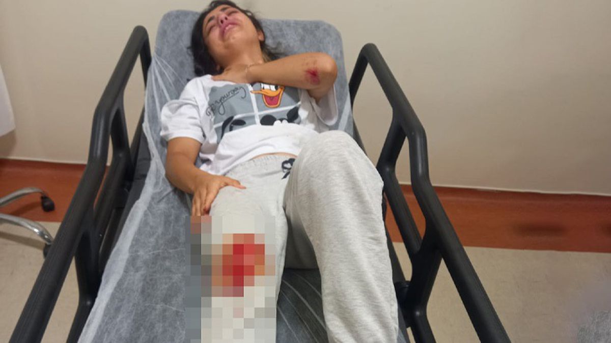 Kastamonu'da başıboş sokak köpeklerinin saldırdığı kadın hastanelik oldu