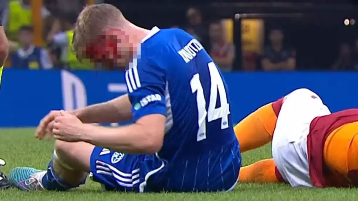 Yürekler ağza geldi! Icardi'yi durdurmaya çalışan iki oyuncu çarpıştı, birinin kafası yarıldı