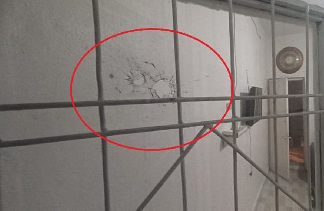 Evinde oturan 15 yaşındaki genç kız, maganda kurşunuyla başından vurulup ağır yaralandı Evinde oturan 15 yaşındaki genç kız, maganda kurşunuyla başından vurulup ağır yaralandı