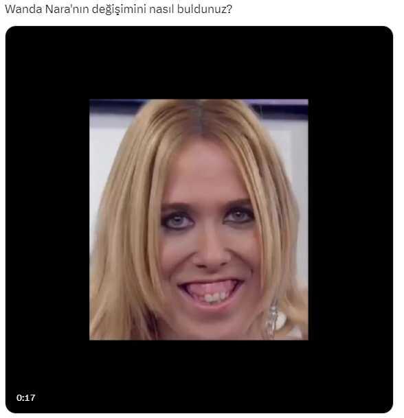Fotoğrafın Wanda Nara'nın estetiksiz halini gösterdiği iddiası Fotoğrafın Wanda Nara'nın estetiksiz halini gösterdiği iddiası