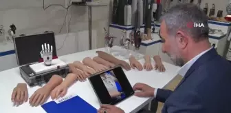 Yarışmadan 1 milyon liralık ödülü kazanan Rabia'nın protezini iş adamı karşılayacak