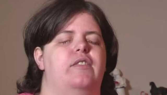 Çocukluğundan beri kör olma hayali kuran kadın gözüne lavabo açıcı dökerek kendini kör etti