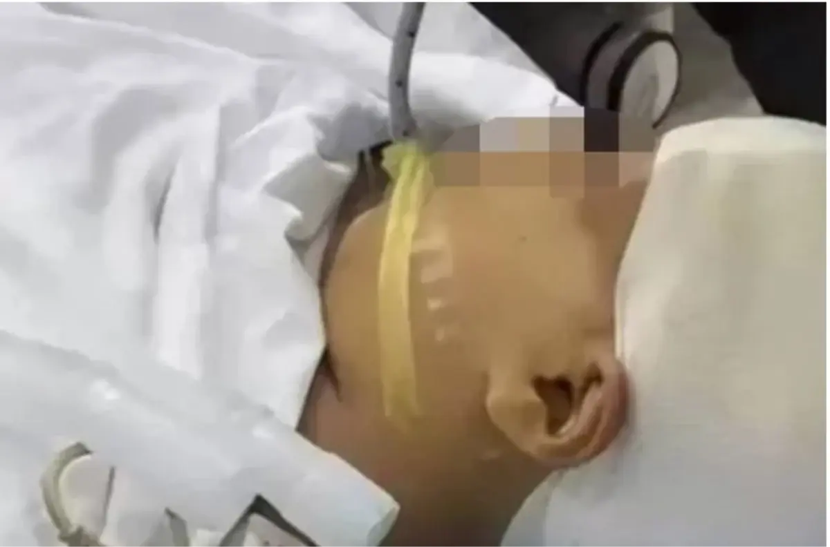 Öğretmen 9 yaşındaki öğrencisinin kafasına metal cetvelle vurarak kafatasını parçaladı