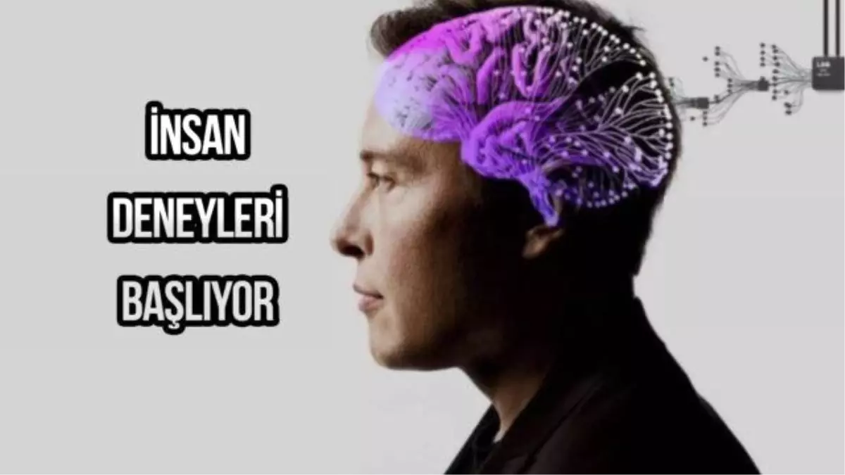 Elon Musk'un Neuralink Şirketi İnsan Deneyi İçin Deneğe Başvuruları Açtı