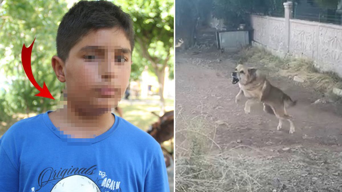 Köpeğin saldırıp boynunu ısırdığı çocuk, hayatının dehşetini yaşadı