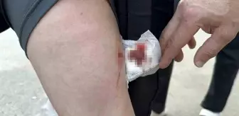 Sokak köpeğinin saldırısına uğrayan kız çocuğu okula gidemiyor