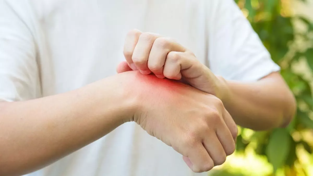 Behçet hastalığı nedir? Behçet hastalığı bulaşıcı mı? Behçet hastalığı tedavisi nasıl yapılır?