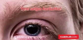 Kırmızı Göz hastalığı nedir, tedavisi var mı? Pakistan'da çıkan yeni virüs, salgın ne?