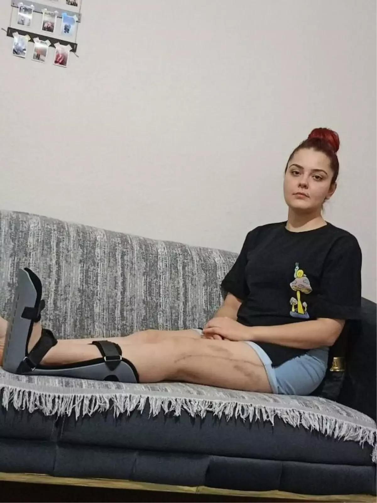Kadın, ayrılmak istediği sevgilisi tarafından vurulduğunu iddia etti