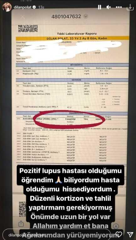 Lupus hastalığı nedir, belirtileri neler? Dilan Polat, lupus hastalığına mı yakalandı?