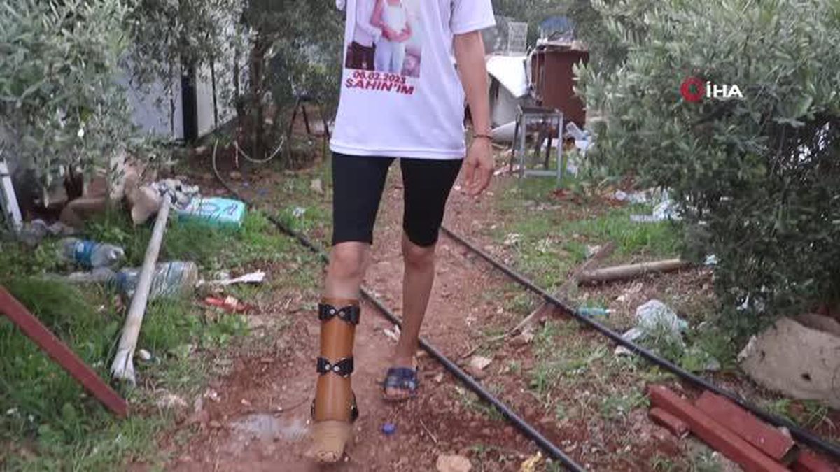 Depremde kolunu kaybeden anne, kızıyla olan hayallerini gerçekleştirebilmek için biyonik kola kavuşmak istiyor