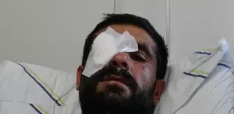 Ağrı'da Av Tüfeğiyle Vurulan Kişi Görme Yetisini Kaybetti