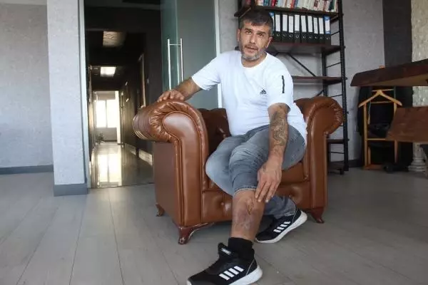 16 yıl önce ameliyat olan adamın bacağın bez parçası unutuldu 16 yıl önce ameliyat olan adamın bacağın bez parçası unutuldu