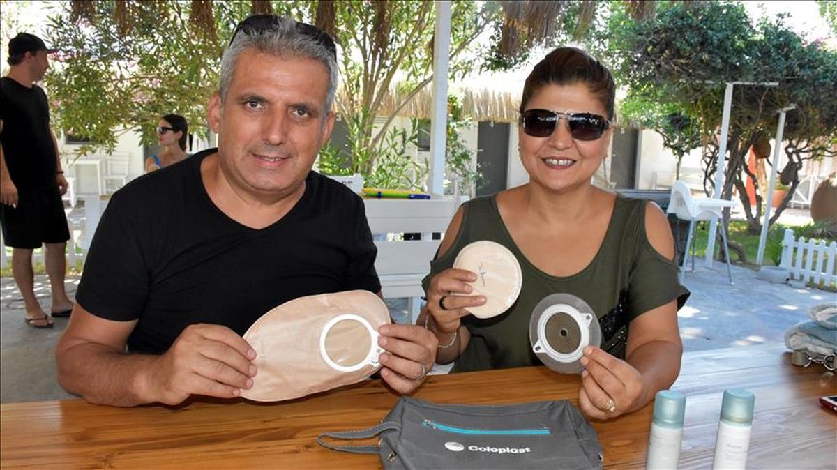 Stoma (Ostomi) hastalığı nedir, tedavisi var mı, belirtileri neler, geçer mi?