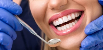 Diş beyazlatma nasıl yapılır, ne kadar sürer? Diş beyazlatma zararlı mı?
