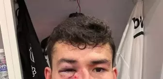 Beşiktaşlı futbolcu Bakhtiyor Zaynutdinov maçta sakatlandı