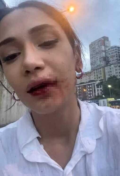 Evlilik Programı Yarışmacılarına Yapılan Şiddet Olayında Sanığa Sadece Adli Para Cezası Evlilik Programı Yarışmacılarına Yapılan Şiddet Olayında Sanığa Sadece Adli Para Cezası