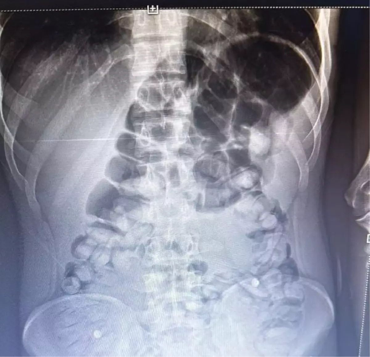 Erzurum'da Yolcu Otobüsünde Afyon Sakızı Bulundu