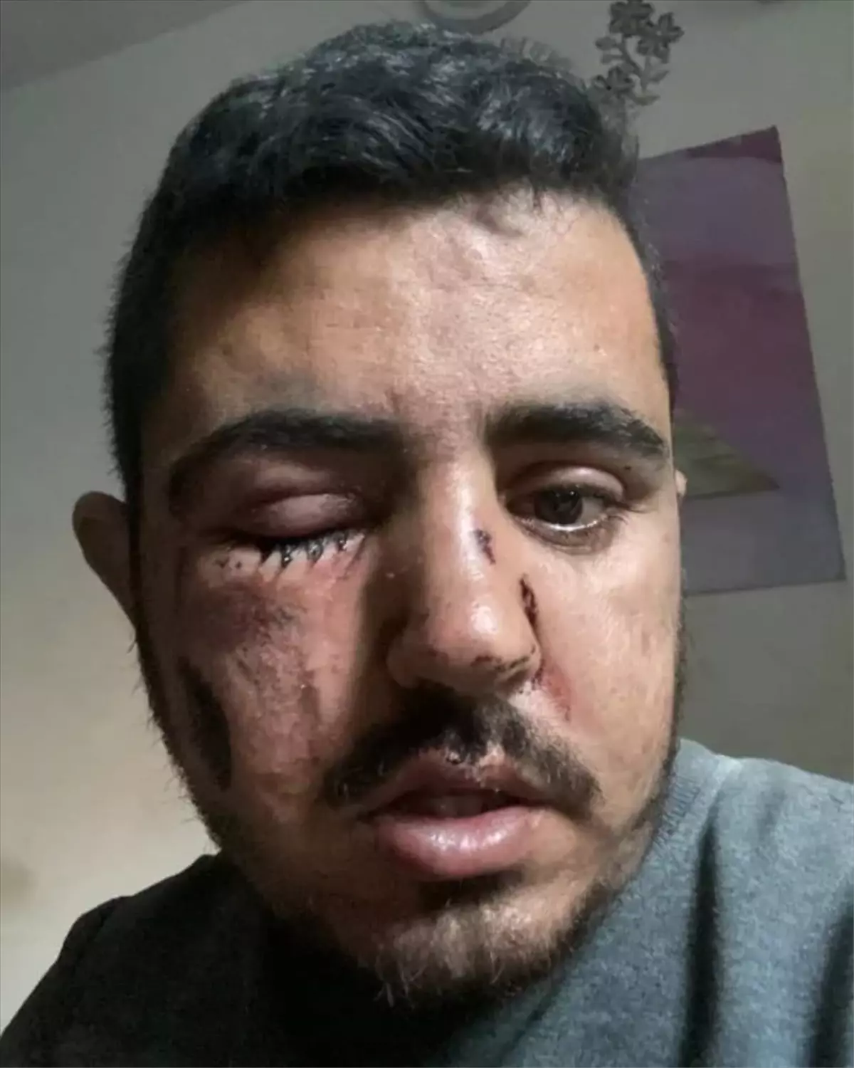 İsrail'in hava saldırısında yakınlarını kaybeden Filistinli kameraman işine devam edecek