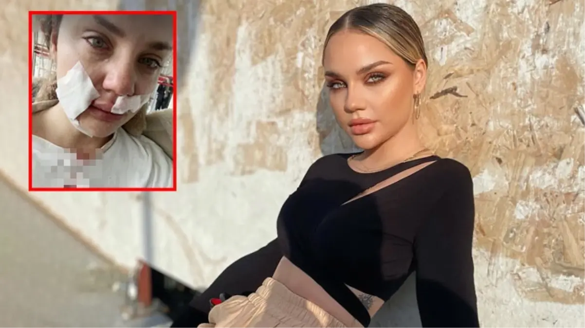 Sosyal medya fenomeni Cansu Yeğin, köpeğinin saldırısına uğradı