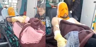 Erzincan'da trafonun patlaması sonucu 2 kişi yaralandı